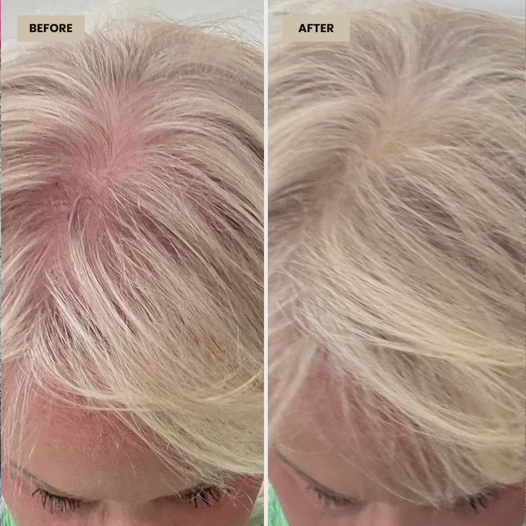 HairBoost Volume Kit