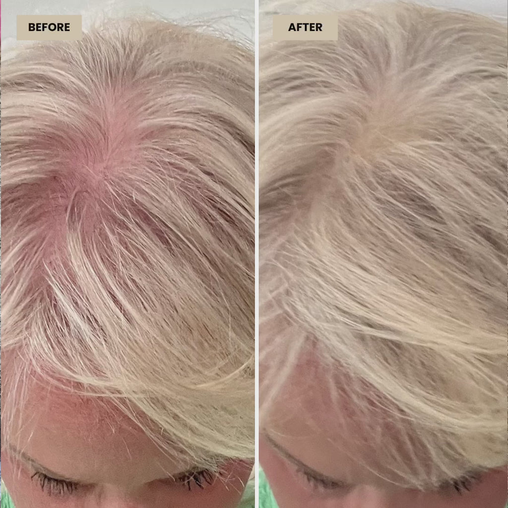 HairBoost Volume Kit